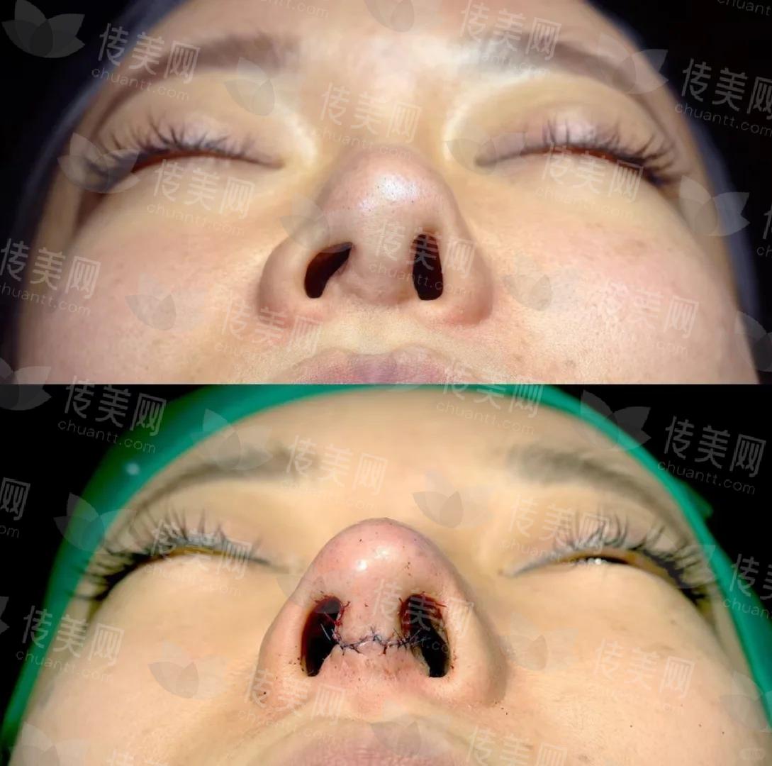 鼻修复日记 _ <span style=