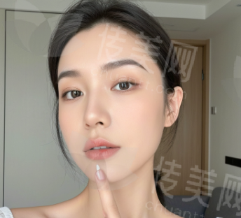 长沙美莱眼综合手术案 例展示