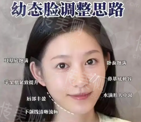 武汉珍妮医疗美容医院怎么样,网友评价好,陈耀文医生擅长眼部整形、幼态脸